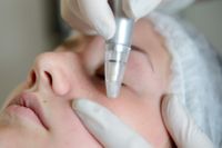 MICRONEEDLING